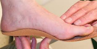 Custom Orthotics in New Westminster: Transform Your Mobility | Royal City Health & Manual Therapy Inc.