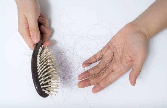 Hair Fall Treatment in Delhi | DermaSure Clinic