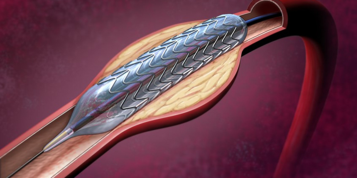 Angioplasty Balloons Market Scope Exploring Technological Advancements and Market Expansion