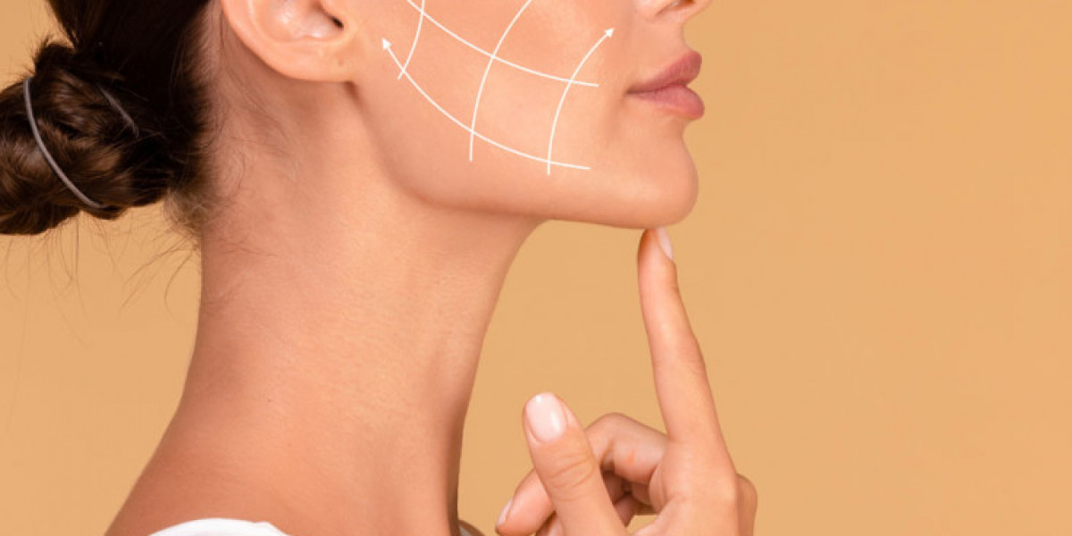 Chin Liposuction in Raleigh, NC: Achieve a More Defined Jawline