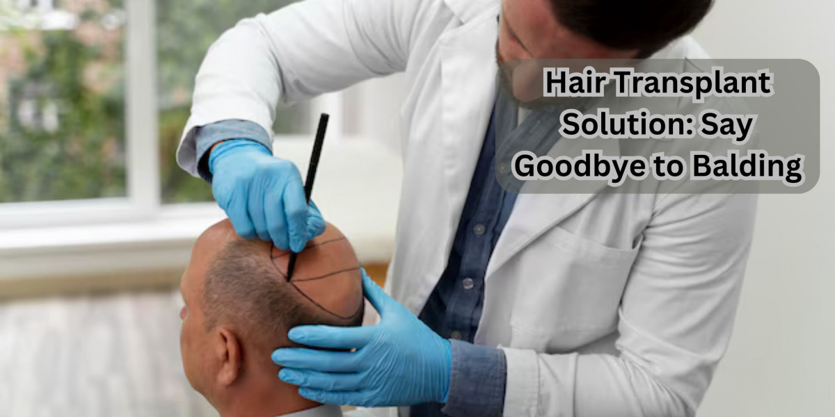 Hair Transplant Solution: Say Goodbye to Balding