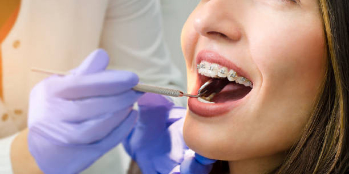 Comprehensive Dental Care Services at Trust Care Dental in McAllen, TX