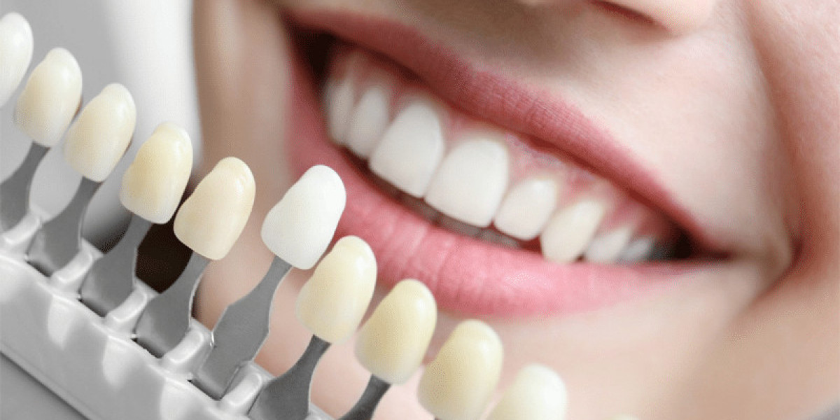 Finding the Right Dentist in Chandler for Quality Dental Care