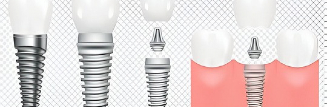 siiodent_implant Cover Image