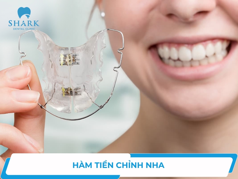 Hàm tiền chỉnh nha là gì? Khi nào cần áp dụng để có hiệu quả