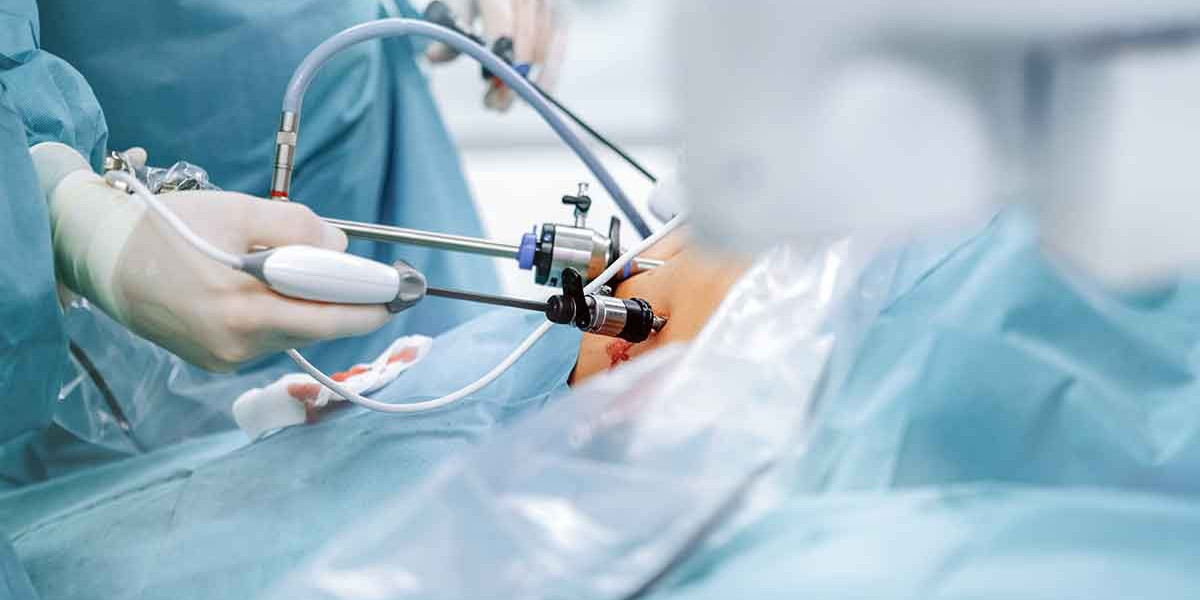 Laparoscopic Devices Market Competition: Assessing Market Share Among Global and Regional Equipment Providers