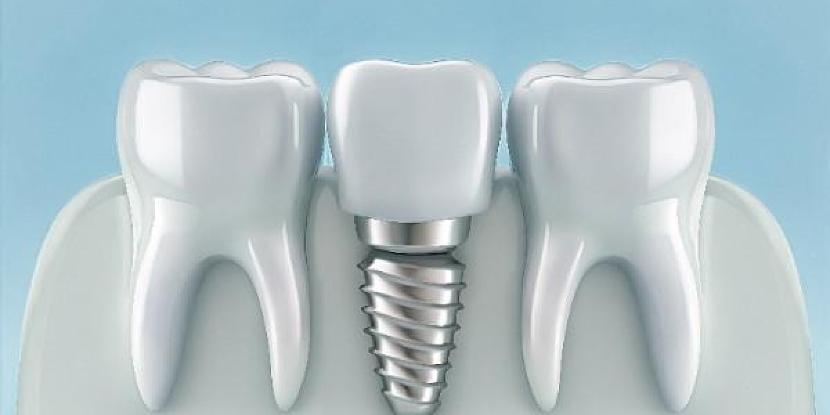 Protecting Your Teeth During Winter in Henley on Thames