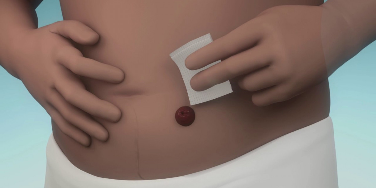 OstomyStoma Care Market Competitive Forces Driving Development and Expansion Across Regions