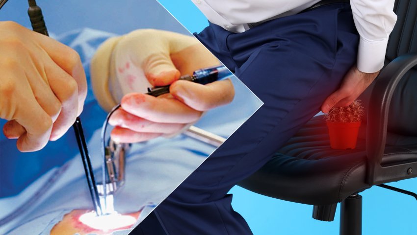 Can laser treatment cure fissures permanently? Dr. Raviram S