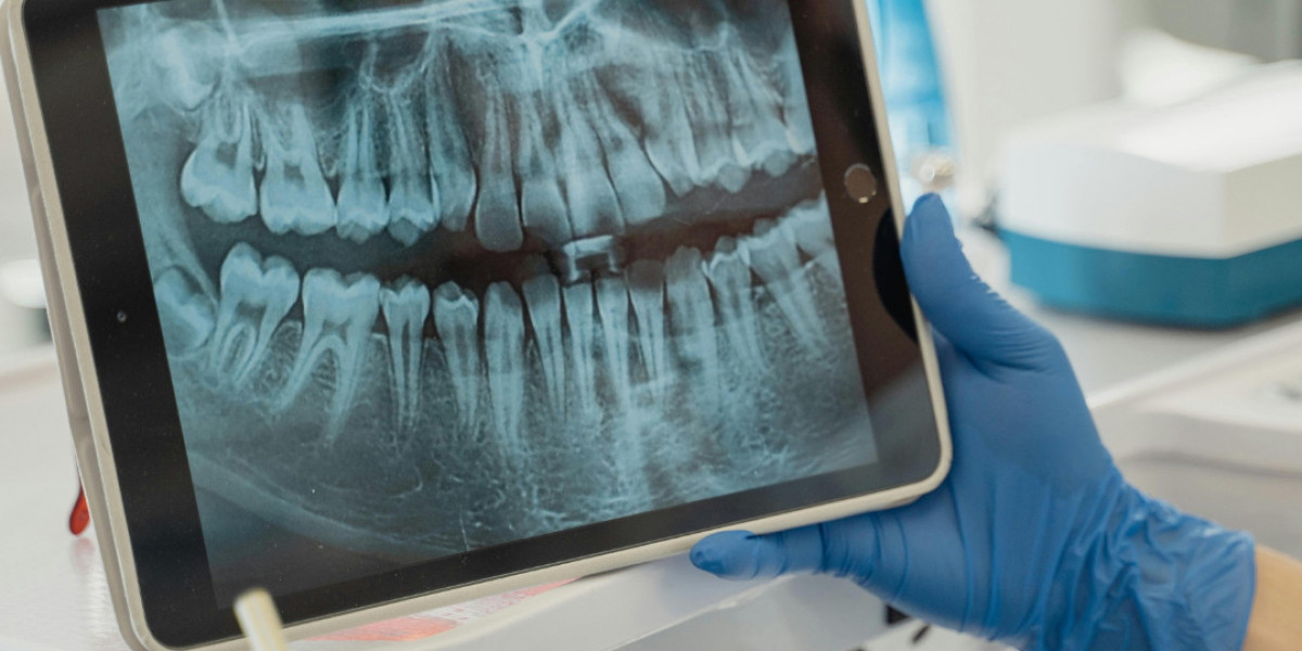 Dental Tips for Seniors: Maintaining Oral Health Over 60